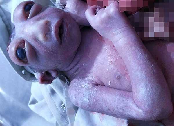 miracle baby pic-2_99704_1