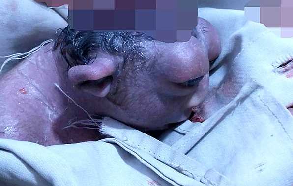 miracle baby pic-3_99704_2