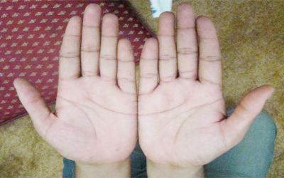 palm
